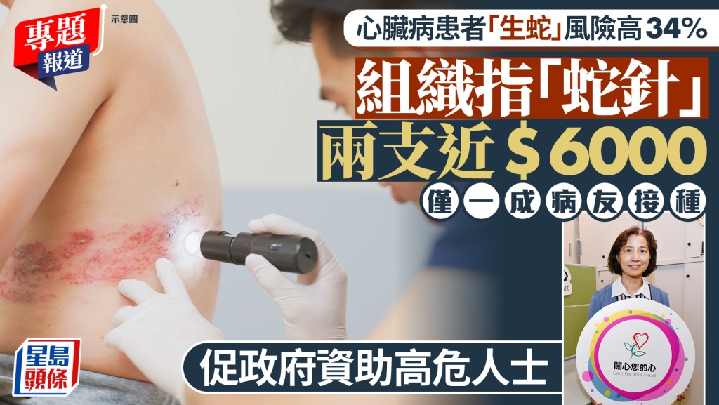 研究指心臟病患者生蛇風險增三成 組織倡政府資助高危群組接種疫苗