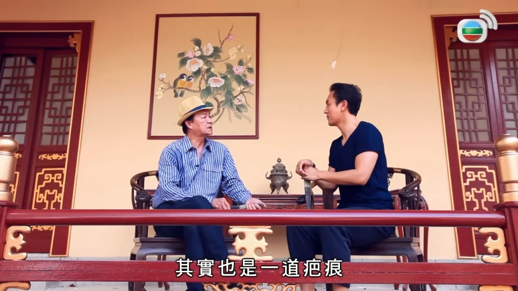 對於當年的嚴苛做法,狄龍坦言此事在他心中,「其實也是一道疤痕」。