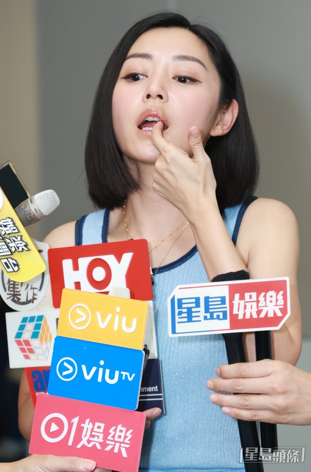 衛詩雅憶述拍攝意外導致嘴唇需要縫合50多針。